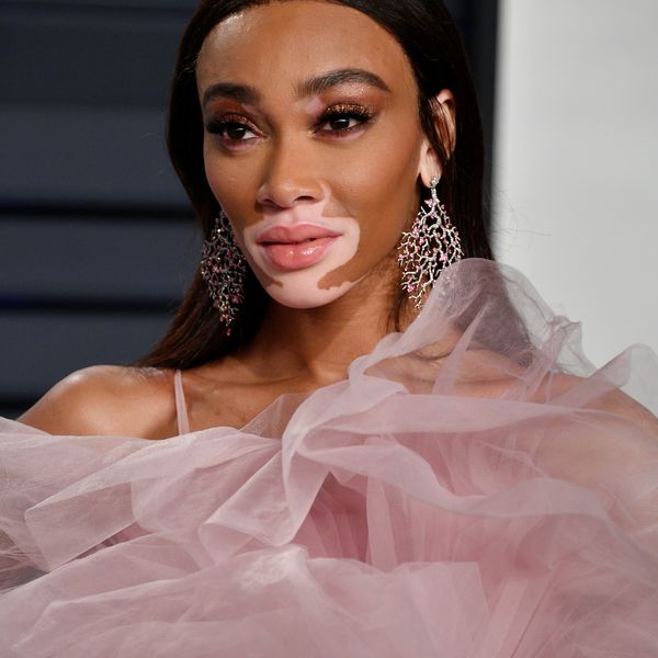 Winnie Harlow