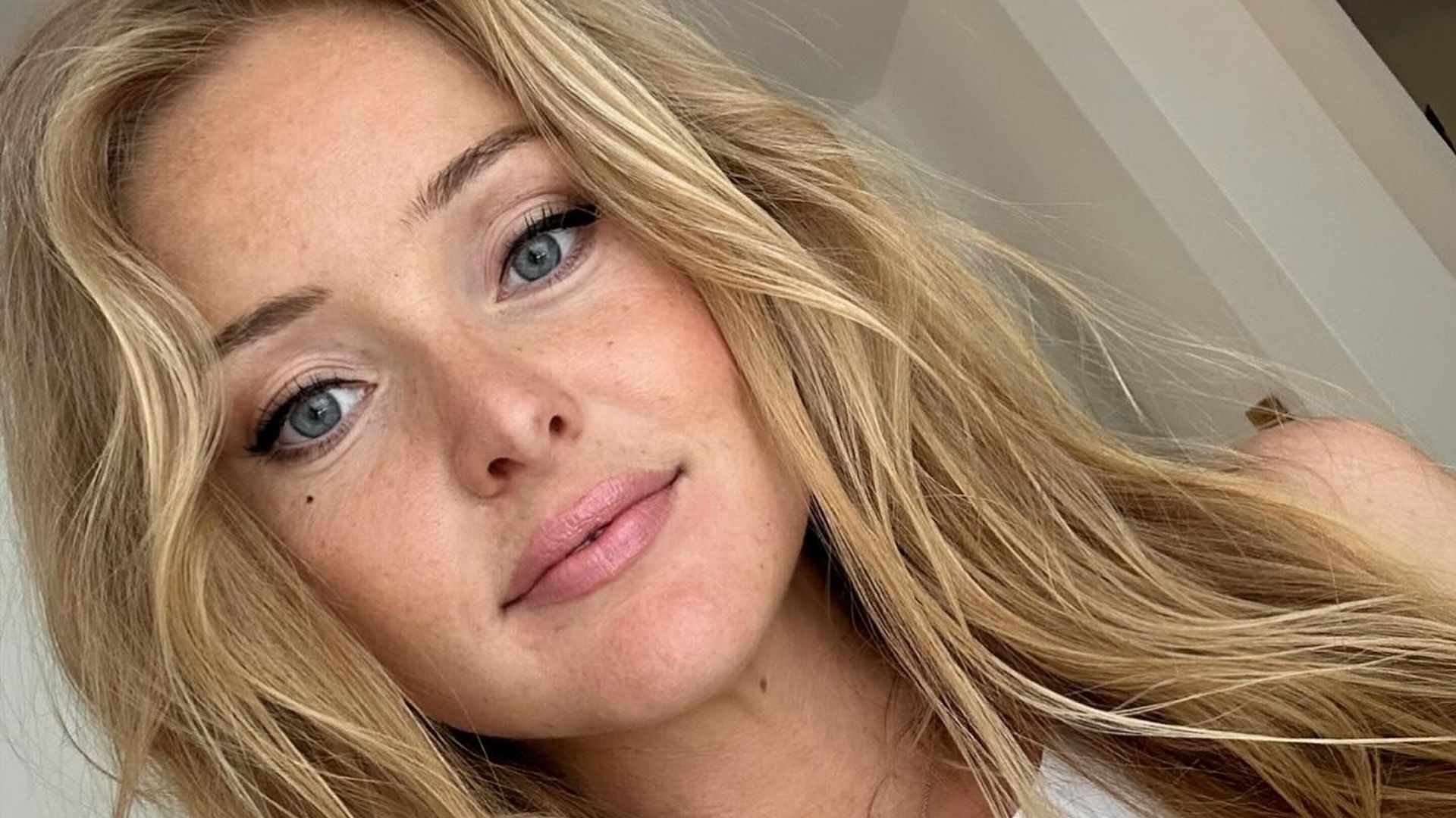 Nie Zuvor So Offen: Patrice Aminati Über Die Palliativbehandlung Im Alltag: Hautkrebs Im Endstadium – Ein Persönlicher Blick. - pehm04m