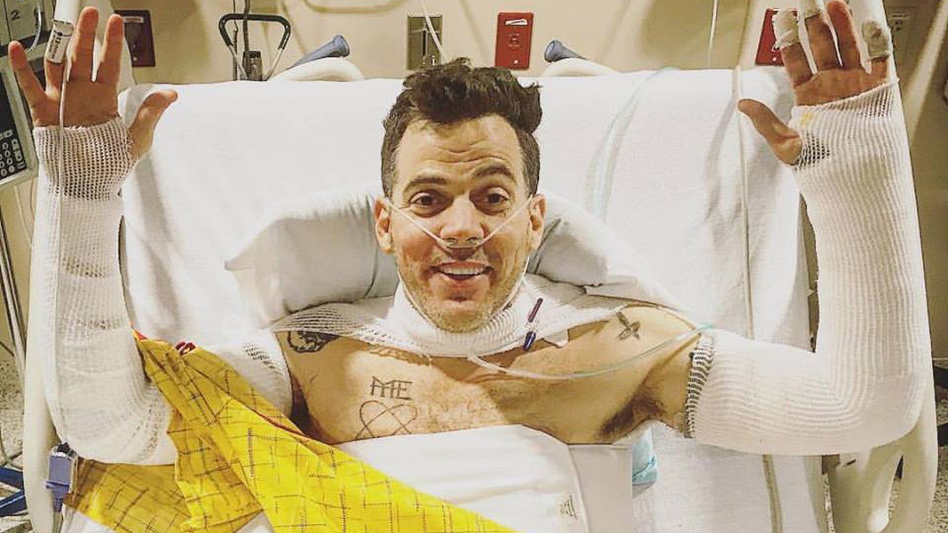 Wegen Pyro-Stunt: Steve-O wird an beiden Armen operiert! | Promiflash.de