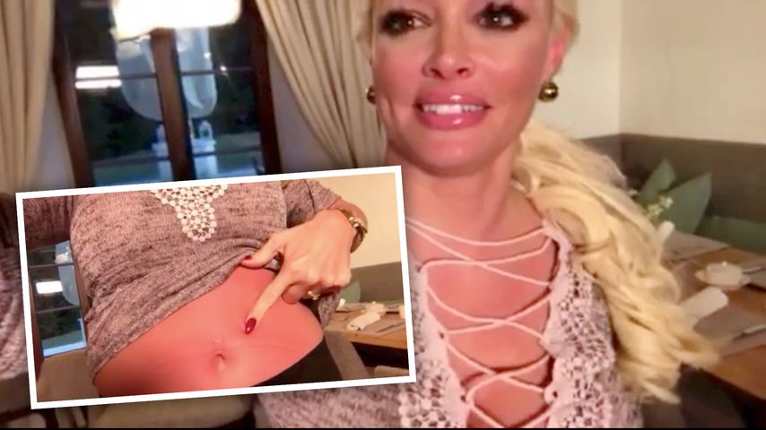 Autsch! Daniela Katzenberger feiert Xmas mit XXL-Sonnenbrand