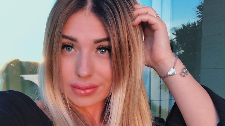 Mega-Shitstorm für Bibi: Hat sie etwa dicke Botox-Lippen?