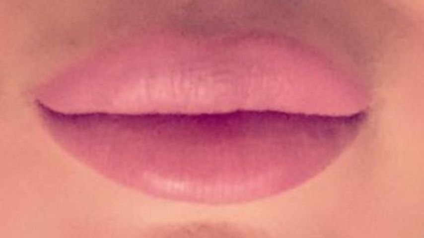 Chethrins aufgespritzte Lippen