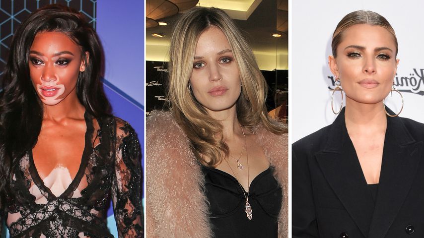 Perfekt unperfekt: Diese 5 Ladys sind schön & NICHT makellos