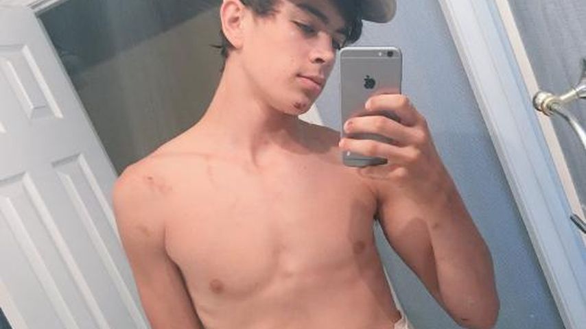 Hayes Grier mit seinen Verletzungen nach seinem Unfall