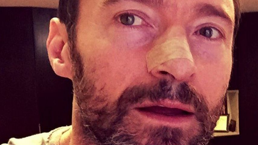 Hugh Jackman nach einer Hautkrebsbehandlung