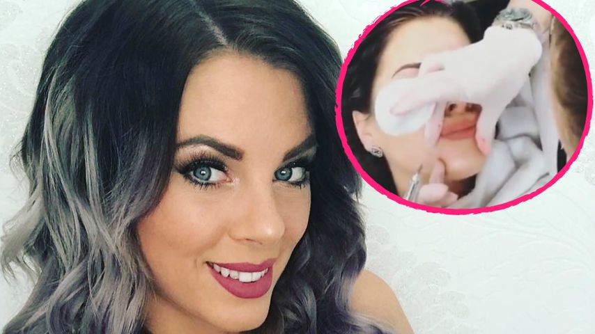 Dschungel-schön? Jenny Frankhauser bekommt Beauty-Eingriffe