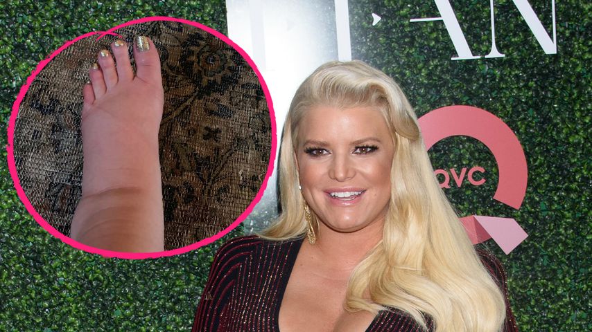 Total geschwollene Füße: Schwangere Jessica Simpson leidet!