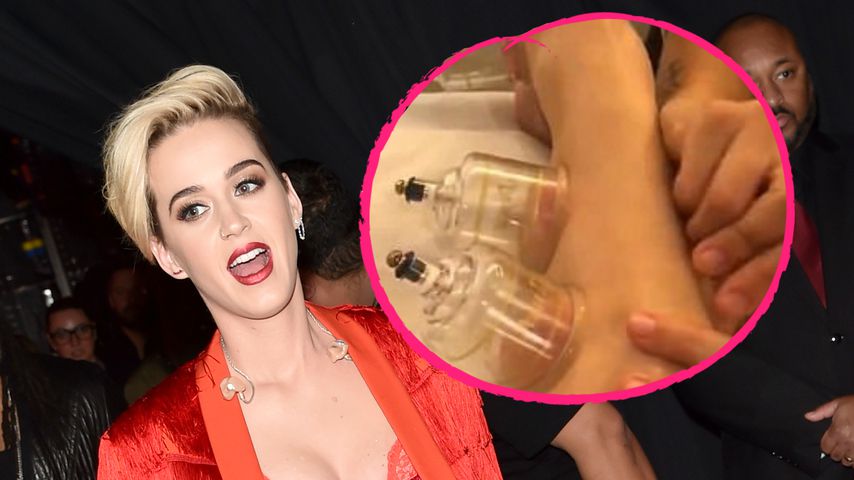 "Cupping-Trend"?! Katy Perry lässt sich die Beine schröpfen!
