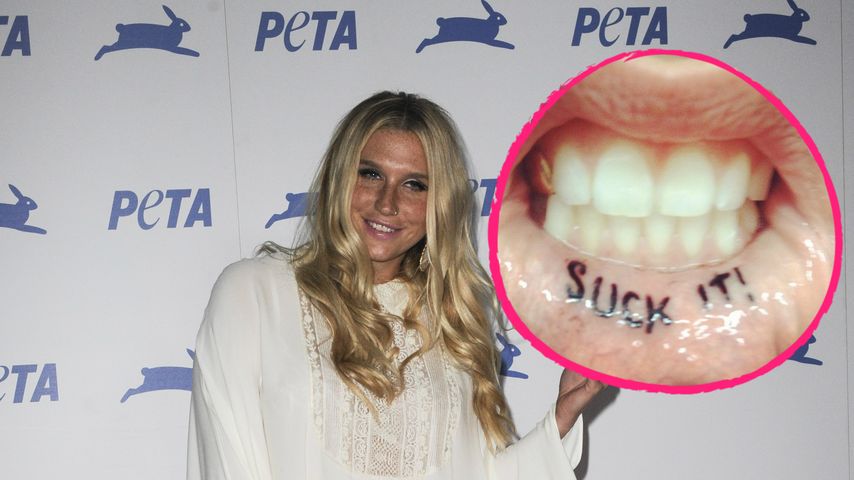 Kesha
