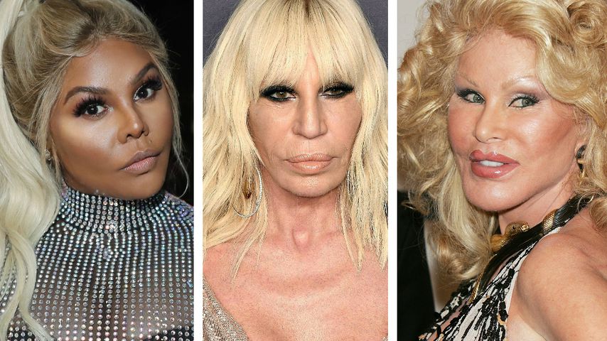 Missglückte Promi-OPs: Beauty-Wahn-Gruselkabinett?