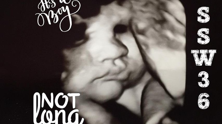 Ultraschallbild von Anna-Maria Zimmermanns Baby