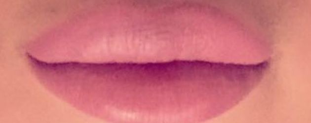 Chethrins aufgespritzte Lippen Chethrins aufgespritzte Lippen