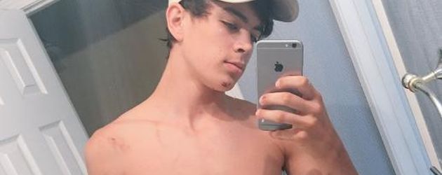 Hayes Grier mit seinen Verletzungen nach seinem Unfall Hayes Grier mit seinen Verletzungen nach seinem Unfall