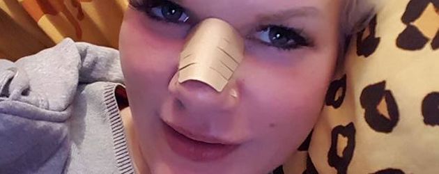 Wieviel braucht man, die Brust irkutske zu vergrössern