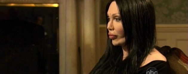 Pete Burns in der US-TV-Show "Celebrity Plastic Surgery: Gone Too Far" Pete Burns in der US-TV-Show "Celebrity Plastic Surgery: Gone Too Far"