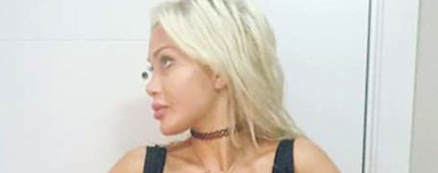 Pixee Fox ließ sich für eine schlankere Taille sechs Rippen entfernen Pixee Fox ließ sich für eine schlankere Taille sechs Rippen entfernen
