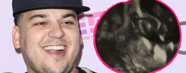 Robert Kardashian mit seinem ungeborenen Baby Robert Kardashian mit seinem ungeborenen Baby